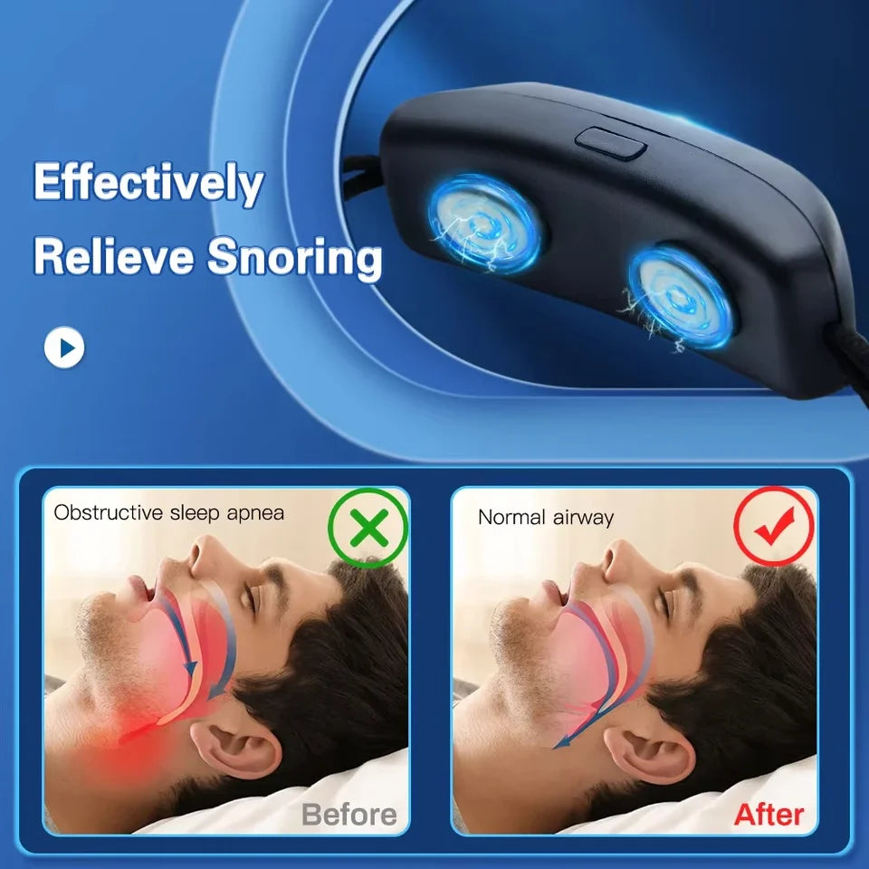 Dispositivo Antironquidos EMS Inteligente USB Para Dormir Mejor